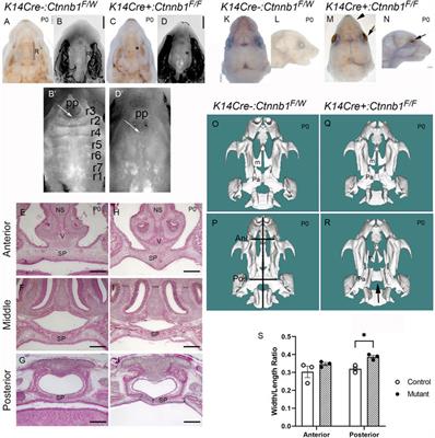 Canonical Wnt signaling is not required for Tgfb3 expression in the basal medial edge epithelium during palatogenesis